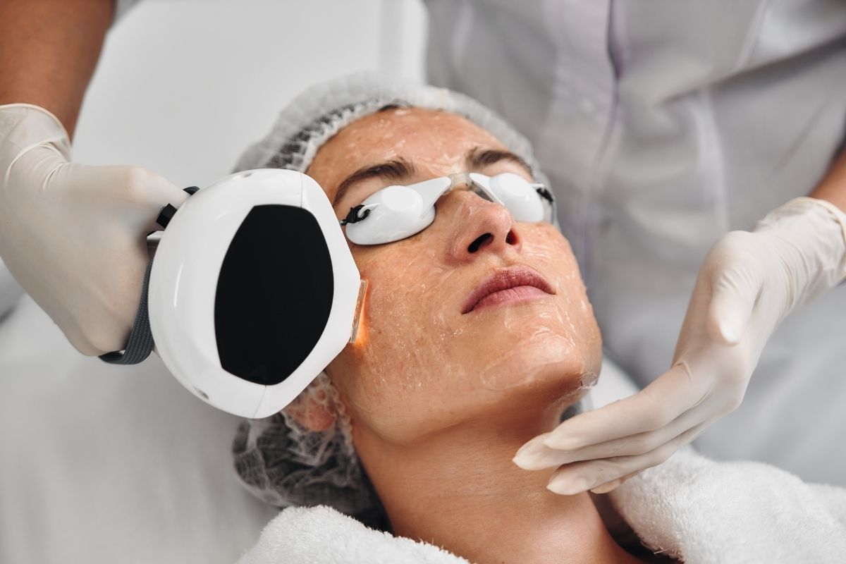 End-Of-Summer Skin Rescue: How To Repair Sun-Damaged Skin This Autumn 2 Ipl Treatment On A Patient'S Cheek At Skin Logic Aesthetics In London