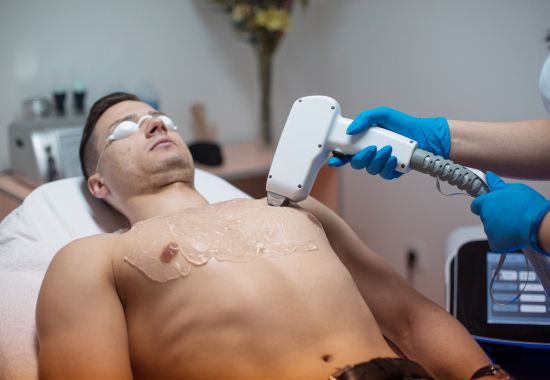 Laser Hair Removal for Men